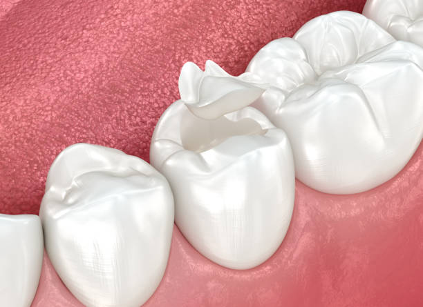 Oral Surgery in Cleveland Heights, OH